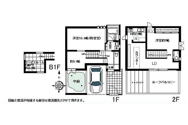 子宮頸がん 手術 円錐切除